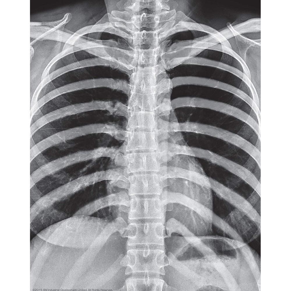 فور إم - الهيكل العظمي المضيئ