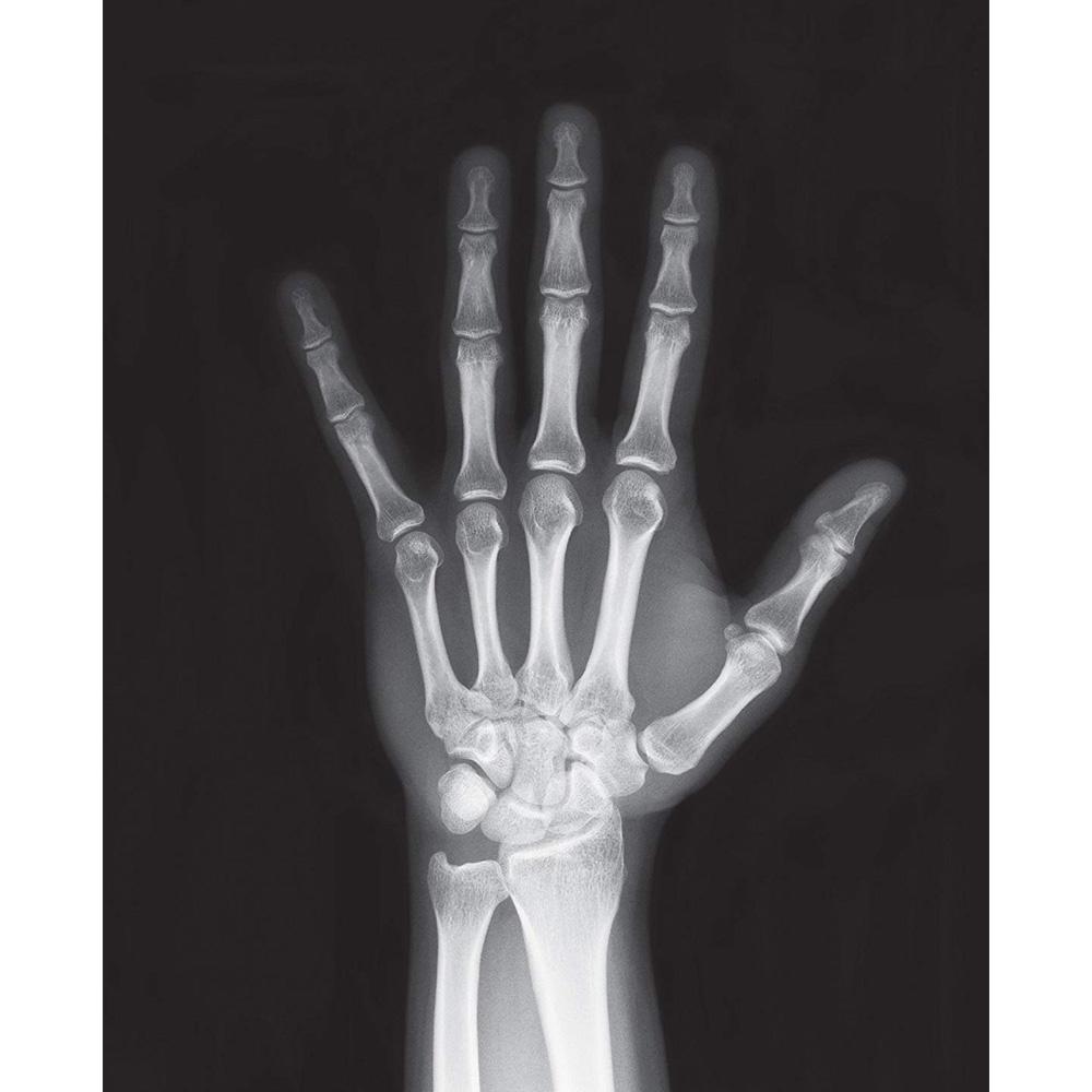 فور إم - الهيكل العظمي المضيئ